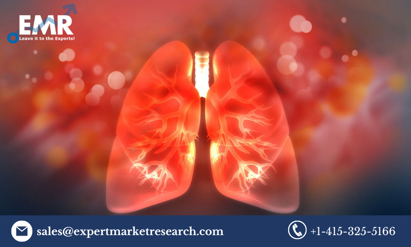 Non-Small Cell Lung Cancer Treatment Market